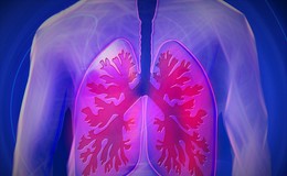 Lungenembolie erkennen und richtig handeln